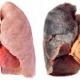Roken en je longen